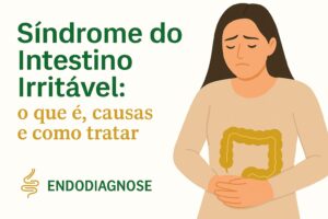 Síndrome do Intestino Irritável